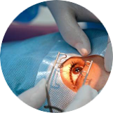 Склеропластика от близорукости Склеропластика от близорукости