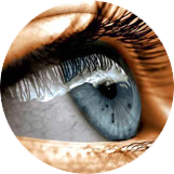 Глаукома в зависимости от степени Глаукома в зависимости от степени